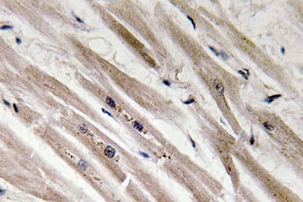 CASP12 / Caspase 12 Antibody (aa50-99)