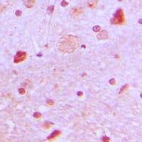 TBX22 Antibody (N-Terminus)