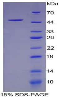 Pig FGF1 / Acidic FGF Protein (Recombinant His-GST)