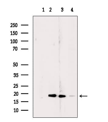 RPL24 / Ribosomal Protein L24 Antibody (aa90-120)