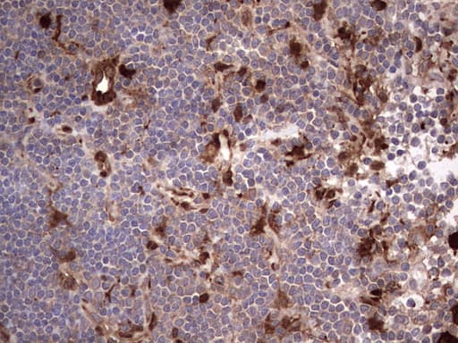 LGALS3 / Galectin 3 Antibody (clone OTI7G9, Carrier-free)