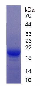 Rat HGF / Hepatocyte Growth Factor Protein (Recombinant His, N-terminus)
