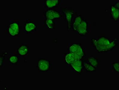 Polyclonal Rabbit anti-Human SWI5 / C9orf119 Antibody (IHC, WB)