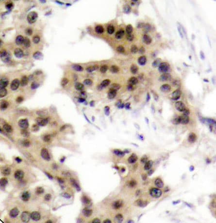 NFKB1 / NF-Kappa-B Antibody (phospho-Ser893)