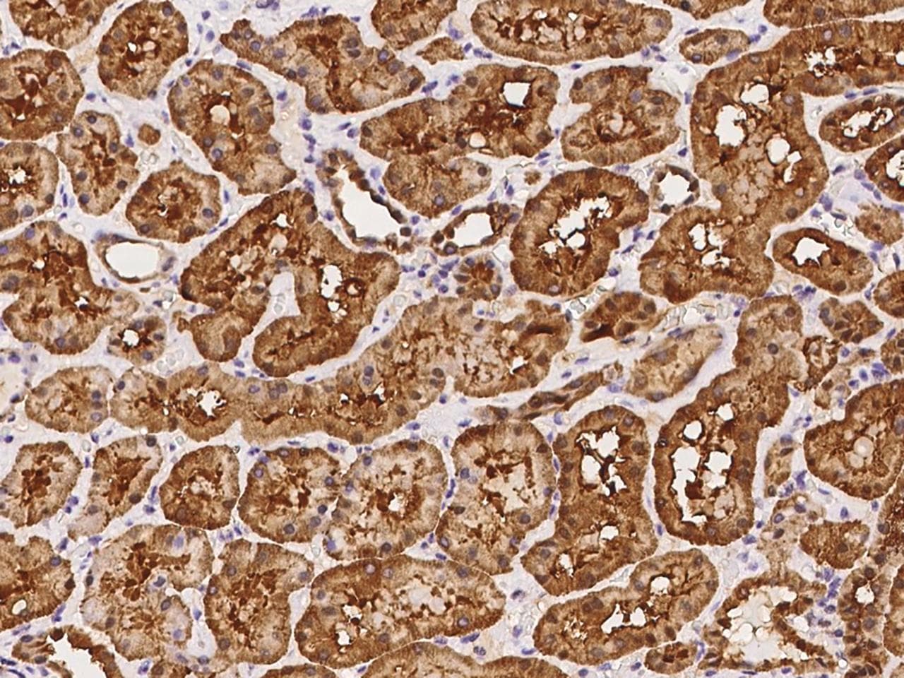 Polyclonal Rabbit anti-Human KIAA1524 / p90 Autoantigen Antibody (IHC)