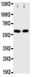 Polyclonal Rabbit anti-Human E2F1 Antibody (aa246-260, WB)