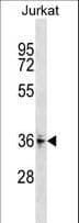 Polyclonal Rabbit anti-Human ZNF346 Antibody (aa188-214, WB)
