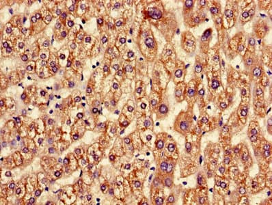 ASGR2 Antibody