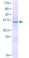 Human N6AMT1 Protein (Recombinant GST)