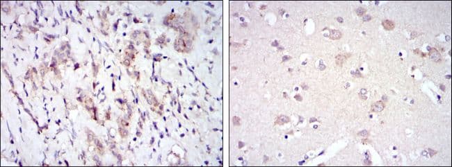 Monoclonal Mouse anti-Human SYN / FYN Antibody (clone 2A10, IHC, IF, WB)