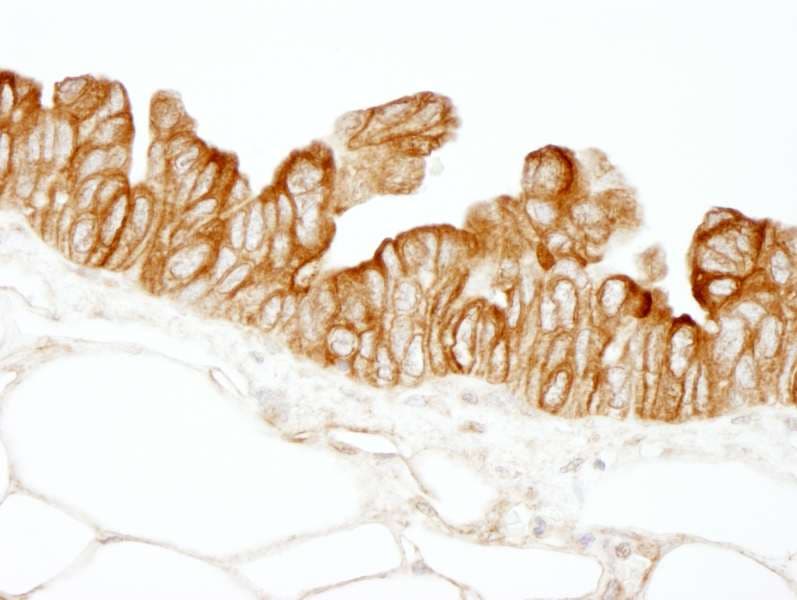 PBXIP1 / HPIP Antibody (aa1-50)
