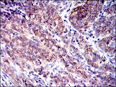 CD9 Antibody (clone 5G6)