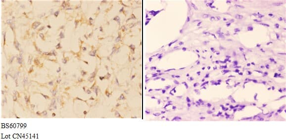 ABCA4 Antibody