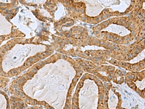 RPL10A Antibody