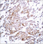 MYC / c-Myc Antibody