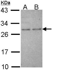 IHC-plus™ HPRT1 / HPRT Antibody (aa23-218)