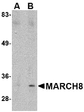 IHC-plus™ MARCH8 Antibody