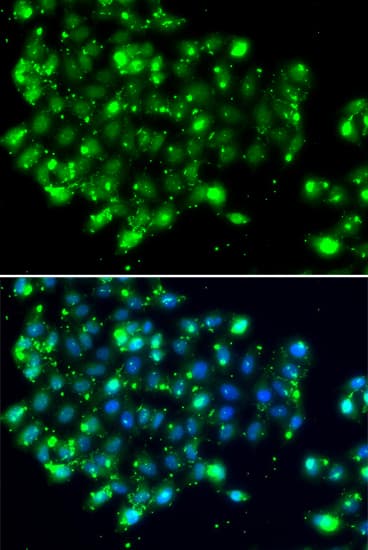 EBS / NAT9 Antibody