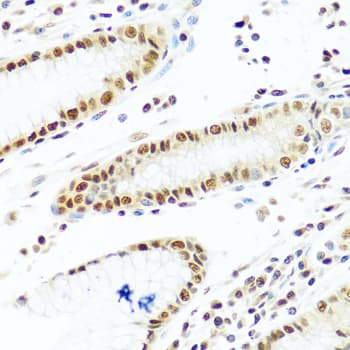 PRPF19 / PRP19 Antibody