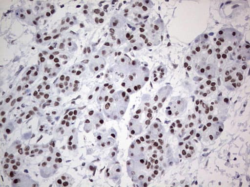 Monoclonal Mouse anti-Human HDAC9 Antibody (clone OTI7G2, aa181-460, IHC, WB)