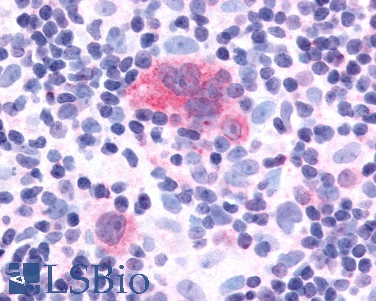 IHC-plus™ CXCR1 Antibody (N-Terminus)