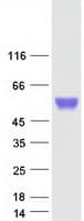 Human CTBS / CTB Protein (Recombinant Myc-DDK (Flag))