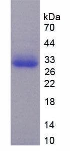 Human TRADD Protein (Recombinant His-T7)