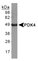 PDK4 Antibody (Internal)