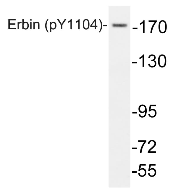ERBB2IP / Erbin Antibody (phospho-Tyr1104)