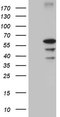 CDY2B Antibody (clone OTI8H6)