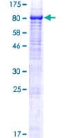 Human KIAA0467 / SZT2 Protein (Recombinant GST)