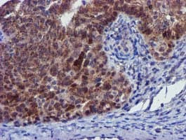 PYCRL Antibody (clone OTI3E1, Carrier-free)