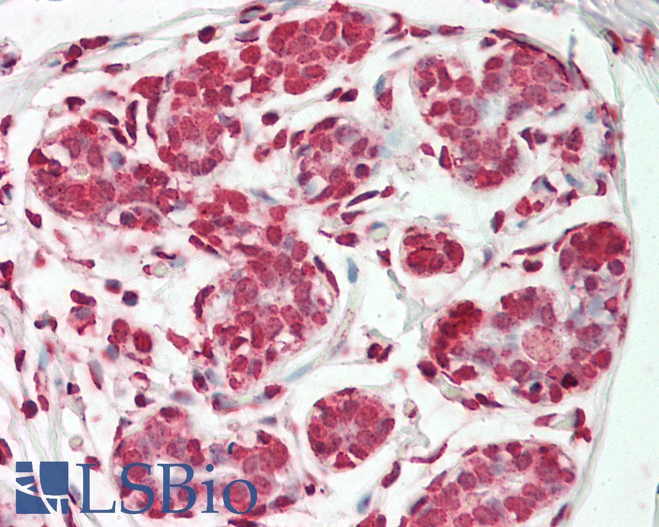 ESE3 / EHF Antibody (aa71-120)