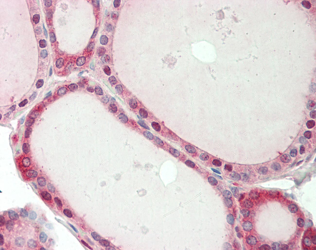 SPG21 / MAST Antibody (aa217-266)