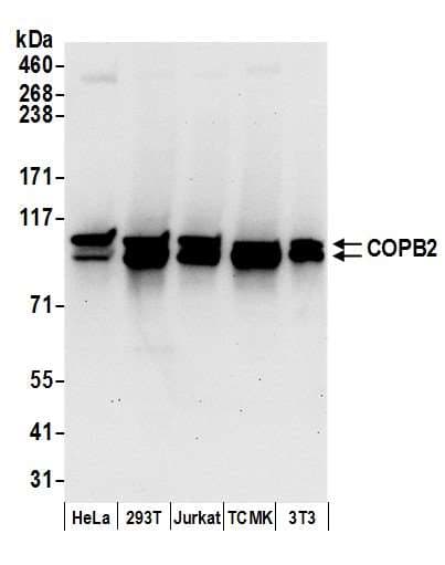 COPB2 / Beta-COP Antibody (aa800-850)