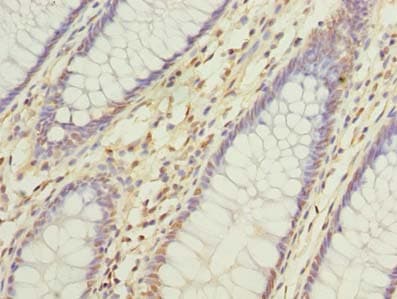 Polyclonal Rabbit anti-Human DNAJC17 Antibody (IHC, WB)