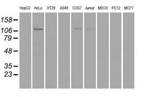 BUB1B / BubR1 Antibody (clone OTI5D9)
