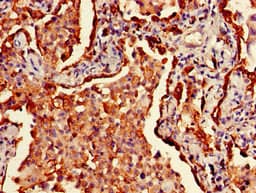 HLA Class II Histocompatibility Antigen, DRB1-3 Antibody (Biotin)