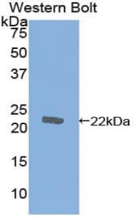 CFL1 / Cofilin Antibody (aa3-161, APC)