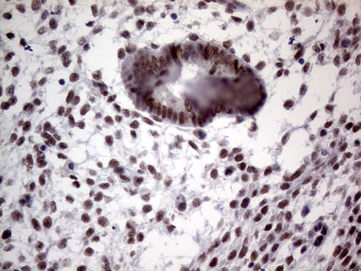 TLK2 Antibody (aa1-296, clone OTI2H2)