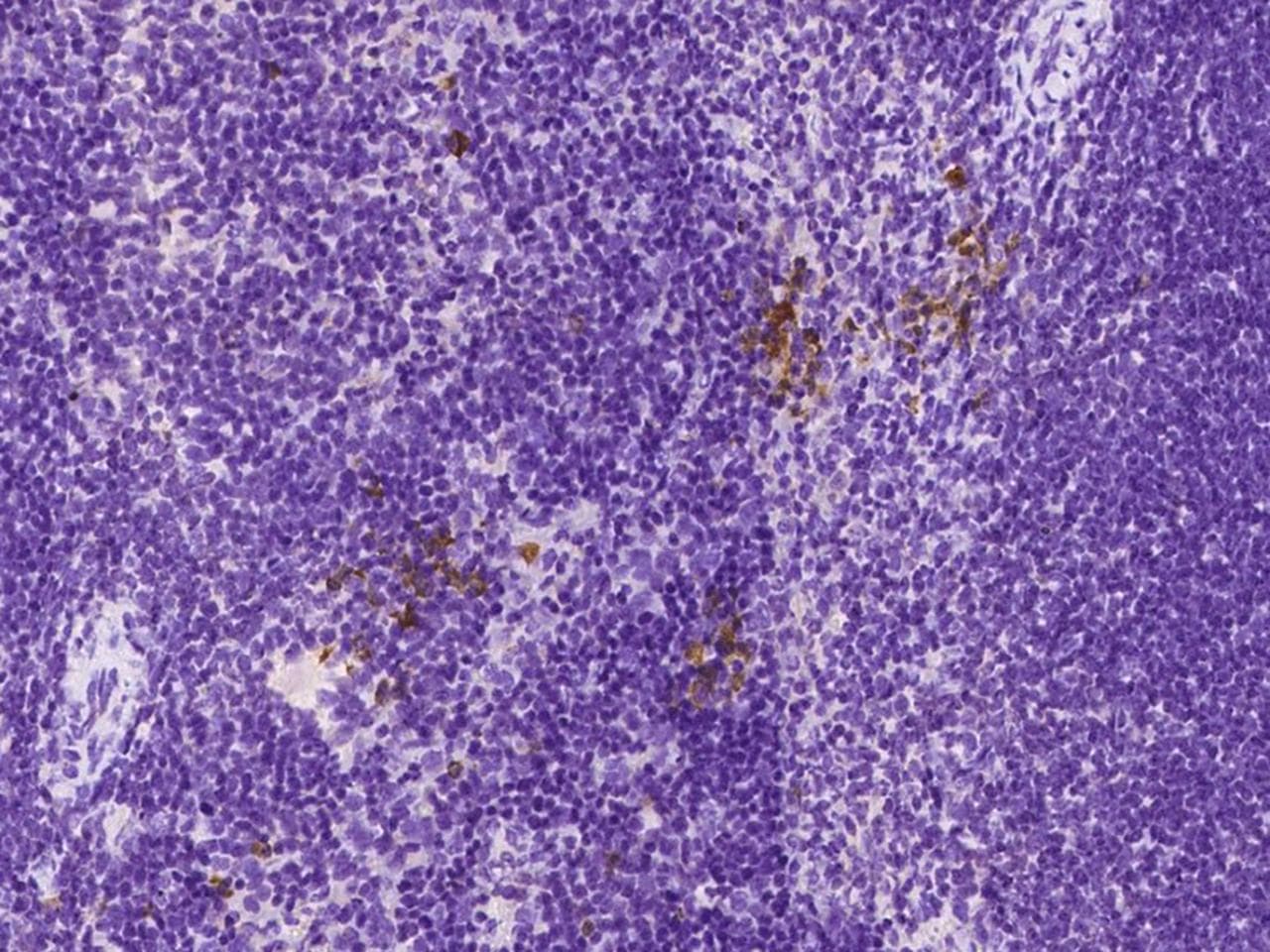 CD8A / CD8 Alpha Antibody (clone 38, Preservative Free)