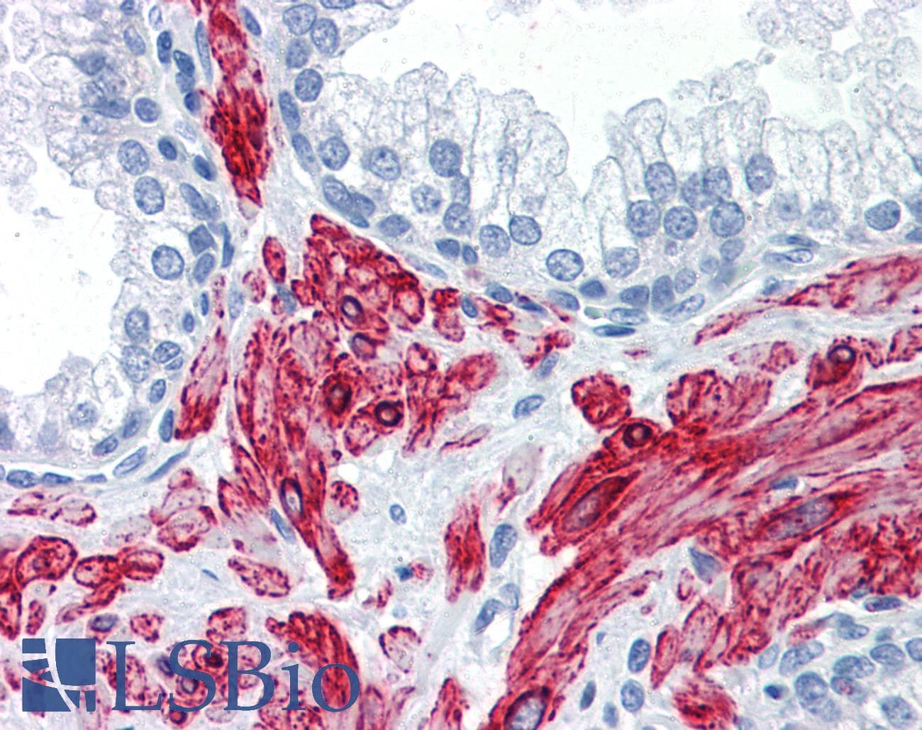 IHC-plus™ SLMAP / SLAP Antibody (clone 2A7)