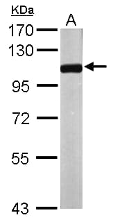 IHC-plus™ NPEPPS Antibody (aa328-648)
