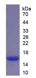 Rat LGALSL / Galectin 5 Protein (Recombinant His)
