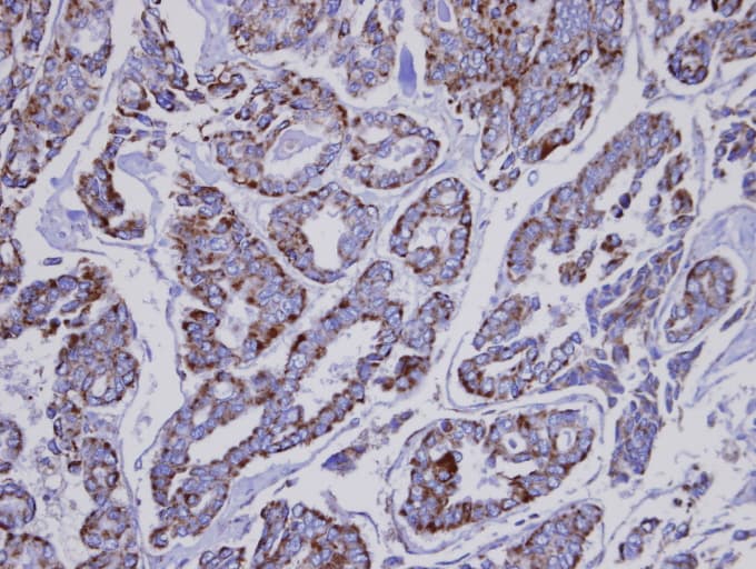 INPP1 Antibody (aa3-269)