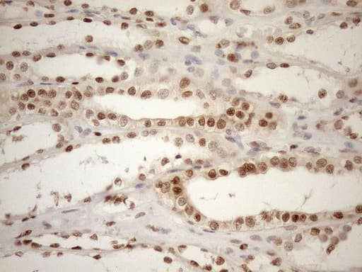 MGMT Antibody (clone OTI5A7)