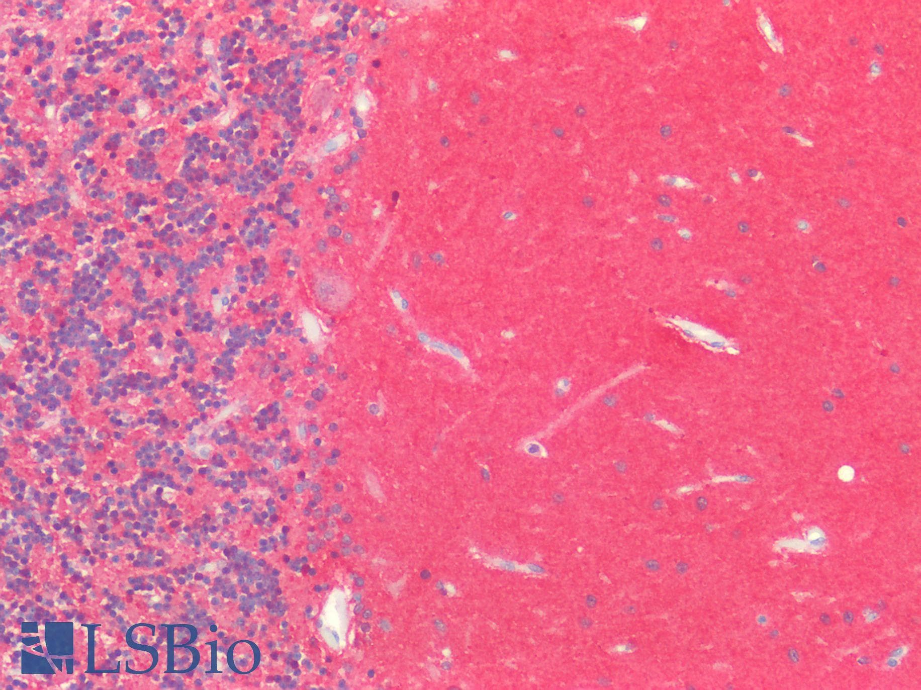 IHC-plus™ MAPT / Tau Antibody (phospho-S721)