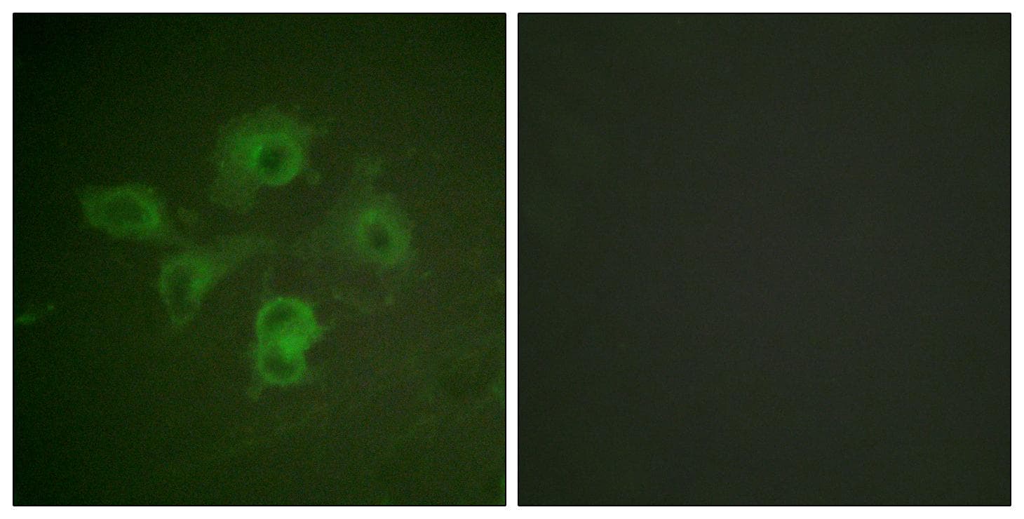 Ephrin B1+B2 Antibody (phospho-Tyr594/604)
