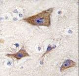 GPR49 / LGR5 Antibody (aa443-473)