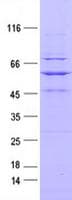 Human ROR2 Protein (Recombinant DDK,C-terminus)